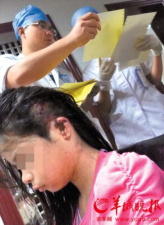 受傷的11歲女孩頭發(fā)被卷入扶梯，耳朵被嚴(yán)重拉傷，需手術(shù)。