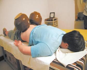 拔泡菜壇子火罐。