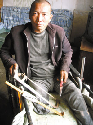 鄭艷良就是用這幾樣簡陋工具，給自己做了右腿截肢手術(shù)。