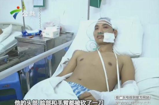 另一名傷者頭部、臉部和手臂都被砍了一刀。(視頻截圖)