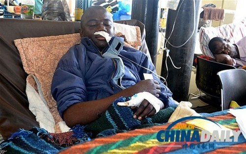 雖然已經(jīng)在醫(yī)院接受了近一個月的恢復(fù)治療，卡托卡的身體仍然非常虛弱。