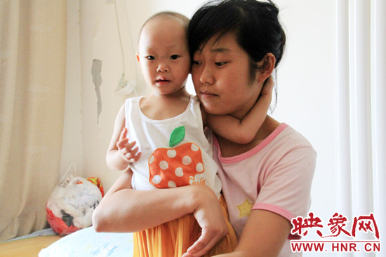 孩子和媽媽在一起，她的右眼已經(jīng)失明。