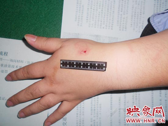 為幫助無證駕駛的朋友逃避處罰，新鄉(xiāng)的王某竟對執(zhí)勤民警大打出手，還將一名民警的手臂咬傷