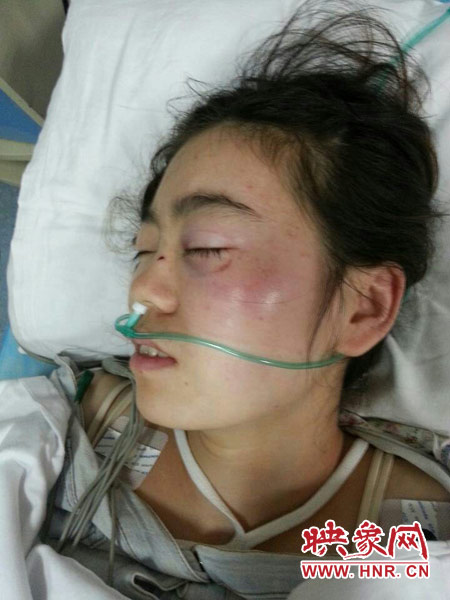 9月10日晚,被暴打的小陳出現(xiàn)了間歇性昏迷,被送進(jìn)了省人民醫(yī)院。