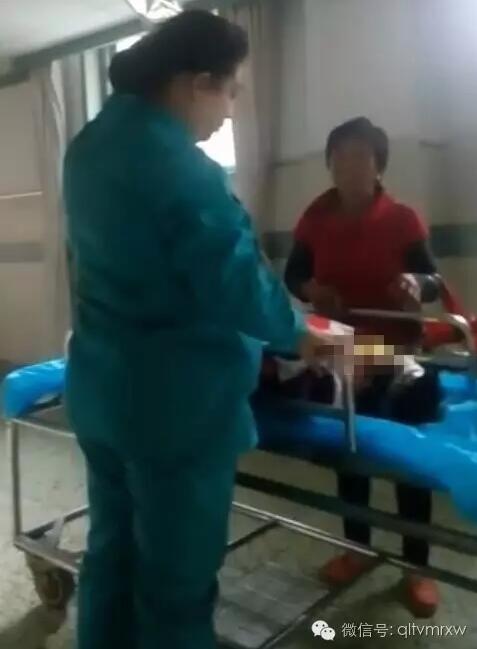 涵涵爸爸告訴《每日新聞》記者：“沒(méi)想到是熱水，大人也沒(méi)看，一時(shí)疏忽，掉進(jìn)去了。抱出來(lái)的時(shí)候這個(gè)皮已經(jīng)掉了。”