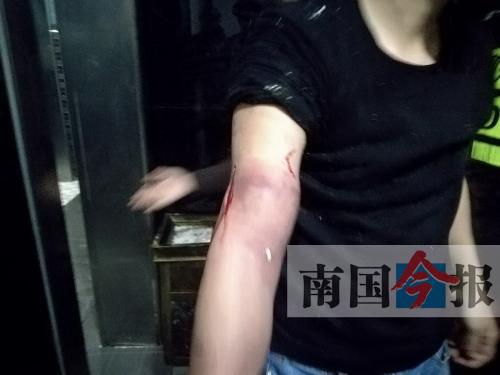 覃先生手臂被卡的部位受傷流血，所幸傷勢無大礙。 通訊員 王建民 攝