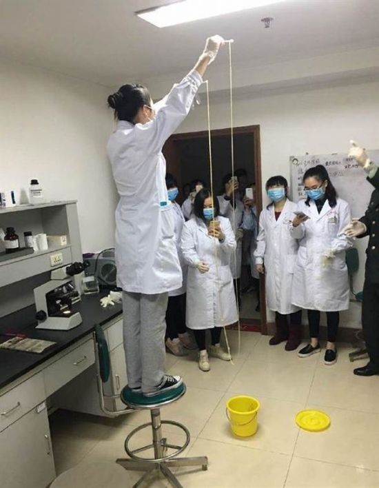 愛吃生肉惹的禍！男子體內(nèi)取出5米長寄生蟲(圖)