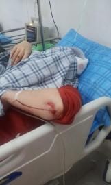 砸窗當(dāng)事人胡女士在醫(yī)院接受治療。