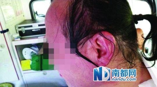 涉事教師遭熱水潑臉后的照片。