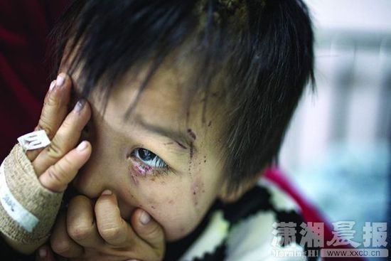 1月13日，湖南省兒童醫(yī)院，4歲的源源用手蒙住了眼睛。