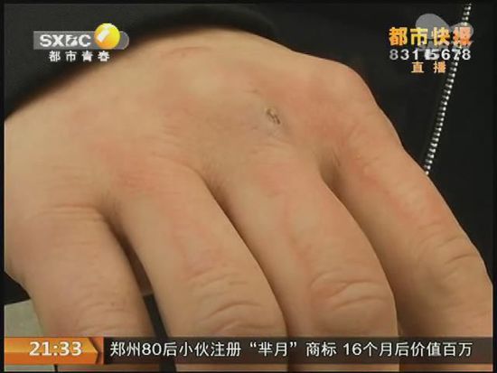 說到這足療拔罐，估計大伙都不陌生，但是想起4號晚上的拔罐的經(jīng)歷，呂先生現(xiàn)在想起來，還心有余悸。
