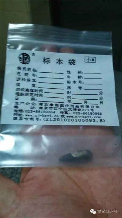 經(jīng)警方鑒定，秦女士體內(nèi)取出的子彈系56式步槍射出 。 受訪者供圖
