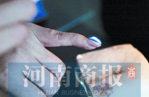 將指甲油涂在指甲上，靠近火焰時被引燃了