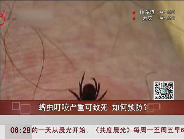蜱蟲叮咬嚴(yán)重可致死如何預(yù)防？